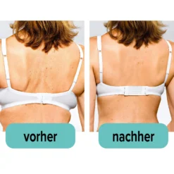 BH-Erweiterung 3 Haken weiß-schwarz-haut 6er-Set