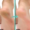 Gel-Socken rose + blau 2 Paar