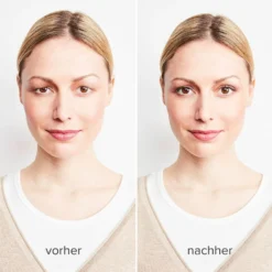 Lidstraffer unsichtbar, 240er-Set