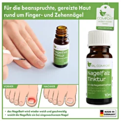 Nagelfalz-Tinktur Vital Comfort