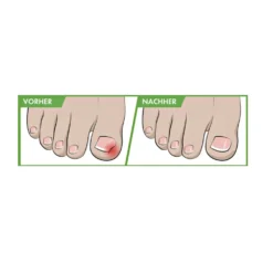 Nagelweichmacher "Vital Comfort"