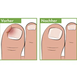Pediküren-Eckenfeile Vital Comfort