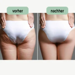 Schlankheits- / Anti-Cellulite-Wärmecreme